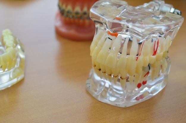 Zdjęcie technologia implantów dentystycznych na modelu szczęki ludzkiego zęba