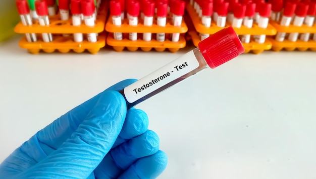 Test hormonów płciowych Testosteron z próbką krwi