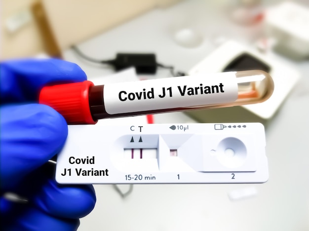 Zdjęcie test sars-cov2 variant jn1 koncepcja zdrowia medycznego