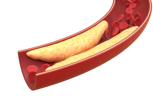 Tłuszcze I Czerwone Krwinki W Naczyniach Krwionośnych 3d Rendering Komputerowy Rysunek Cyfrowy