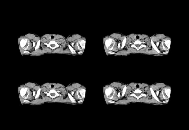 Tomografia klatki piersiowej i kreatywne obrazy MRI