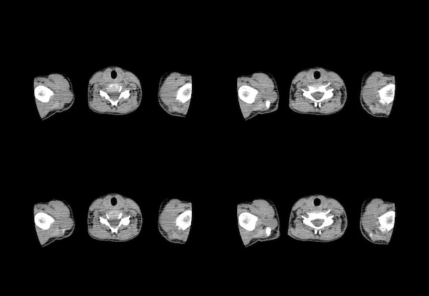 Tomografia komputerowa klatki piersiowej i kreatywne obrazy MRI