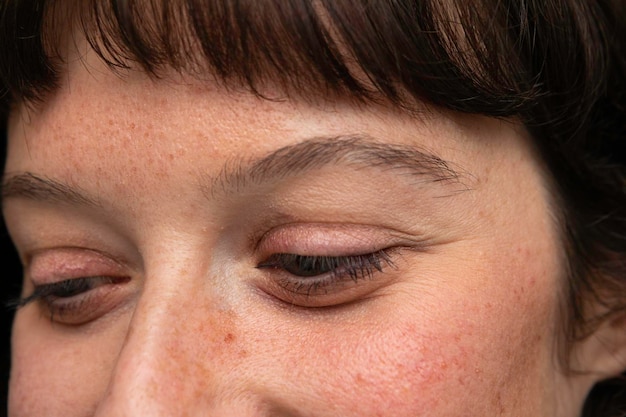 Twarz kobiety z powiększonymi porami, plamami pigmentacyjnymi z bliska