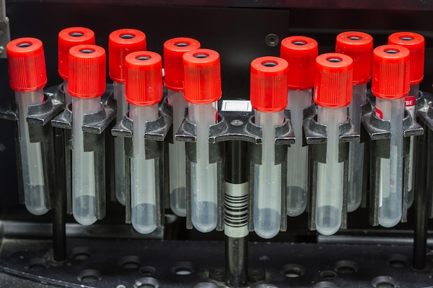 Wirówka testowa separacji krwi w laboratorium chemicznym, sprzęt medyczny