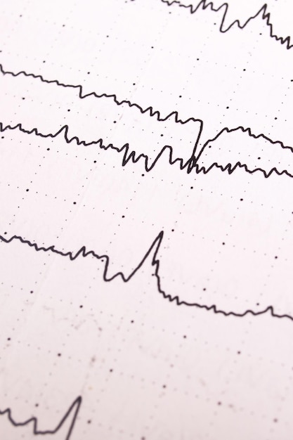 Wykres elektroencefalogramu na białym papierze z bliska