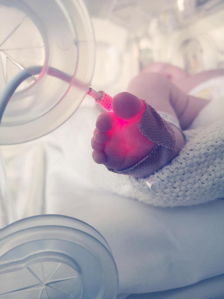 Zdjęcie wysoki kąt widoku nogi chłopca z sprzętem na łóżku w szpitalu