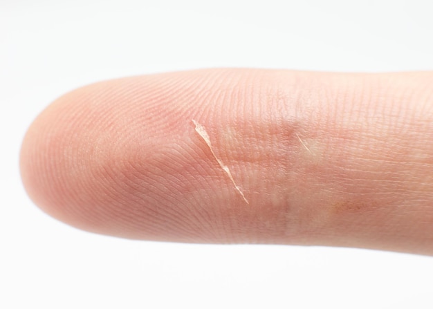 Wytnij na palcu Ludzka skóra tekstury tła. Fotografia makro, z bliska.