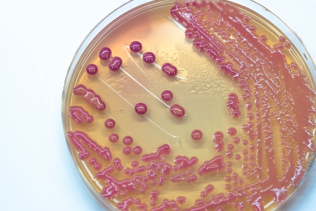 Wzrost hodowli bakterii na agarze w mikrobiologii