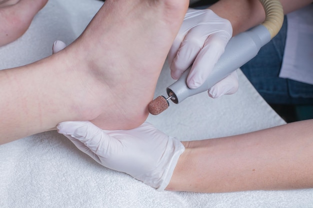 Zabieg pedicure peelingu stóp