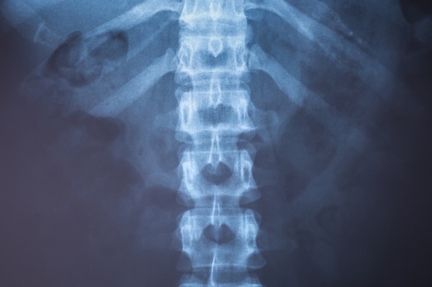 Zamknij obraz rentgenowski człowieka do diagnostyki medycznej