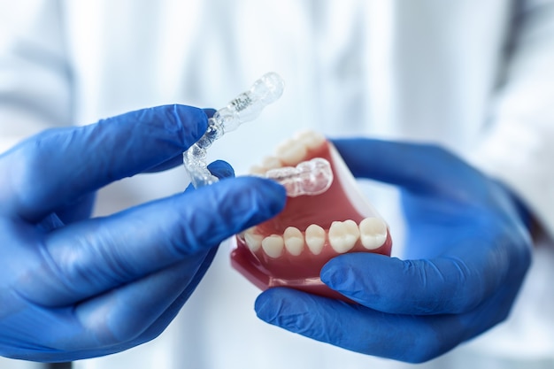 Zbliżenie dłoni lekarza w niebieskich rękawiczkach trzymających sztuczny model żuchwy z niewidocznymi aparatami ortodontycznymi. Dentysta pokazuje przykład wyrównania zębów.