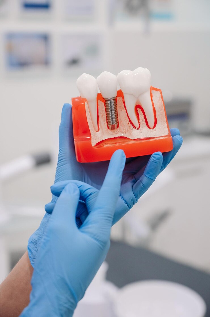 Zdjęcie zbliżenie kobiecej ręki trzymającej pleśń dentystyczną
