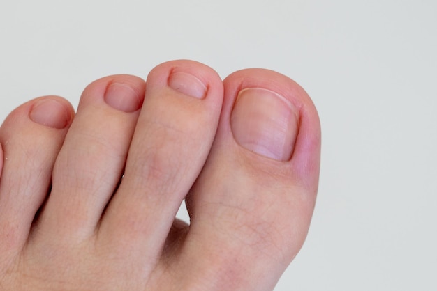 Zbliżenie kobiecych stóp i palców koncepcja zdrowych stóp