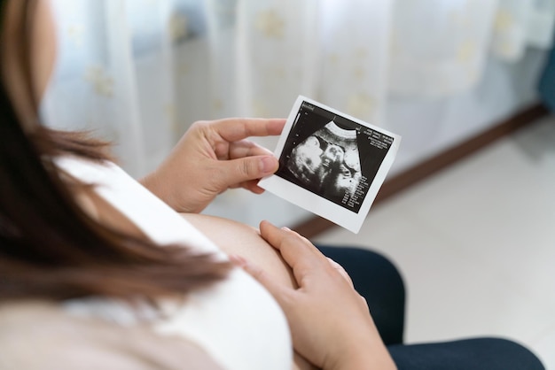 Zbliżenie na ładny brzuch w ciąży i USG rentgenowskie dziecka w ciąży xray