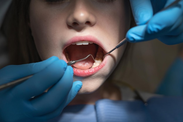 Zbliżenie: otwarte kobiece usta w jasnym świetle w ciemnym gabinecie dentystycznym. Koncepcja leczenia stomatologicznego