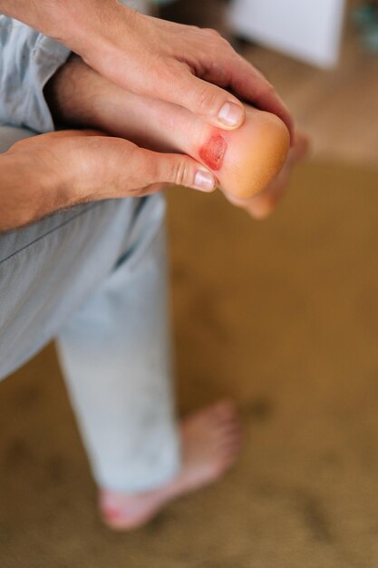 Zdjęcie zbliżony pionowy zdjęcie nieznanego mężczyzny trzymającego stopę z pęcherzem na pięcie mężczyzna cierpiący na ból spowodowany kalusem na pięcie stopy bolesna rana na stopach spowodowana butami