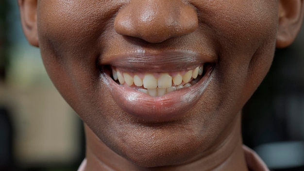Zdjęcia makro kobiety poruszającej ustami w aparacie, pokazujący szczery uśmiech i naturalną zdrową skórę. Młoda kobieta czuje się pewnie z pozytywnym wyrazem twarzy. Autentyczne emocje.