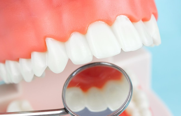 Zdjęcie koncepcyjne stomatologii Zbliżenie indywidualna taca na zęby Ortodontyczny motyw dentystyczny Regularne kontrole są niezbędne dla zdrowia jamy ustnej Narzędzia ortodontyczne system wsporników zębów