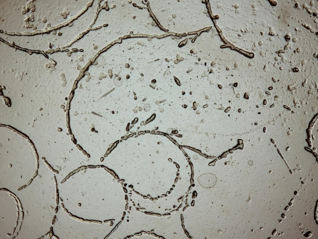 Zdjęcie mikrofotografii zeskrobywania skóry do testu na grzyby pokazujące dermatofity.