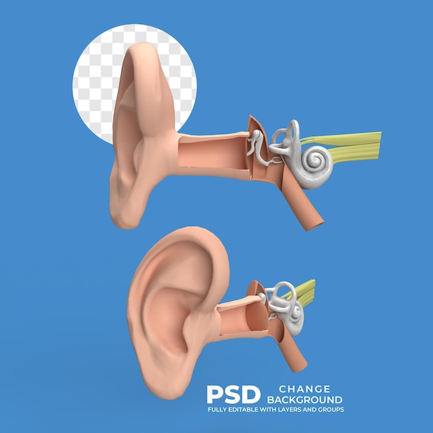 PSD auditory system