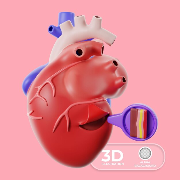 Ilustración de la enfermedad cardíaca pericarditis Ilustración 3d