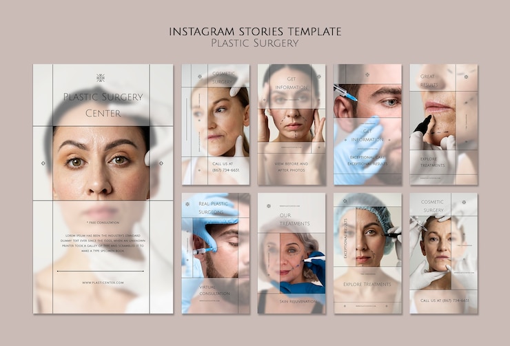PSD gratuito modello di storie di instagram di chirurgia plastica