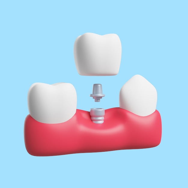 PSD gratuit illustration 3d pour la stomatologie et la dentisterie