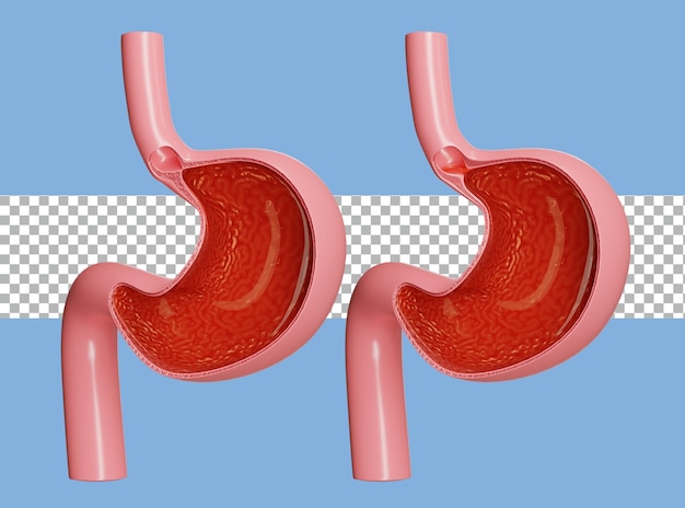 3d haciendo transparente el estómago y el reflujo ácido