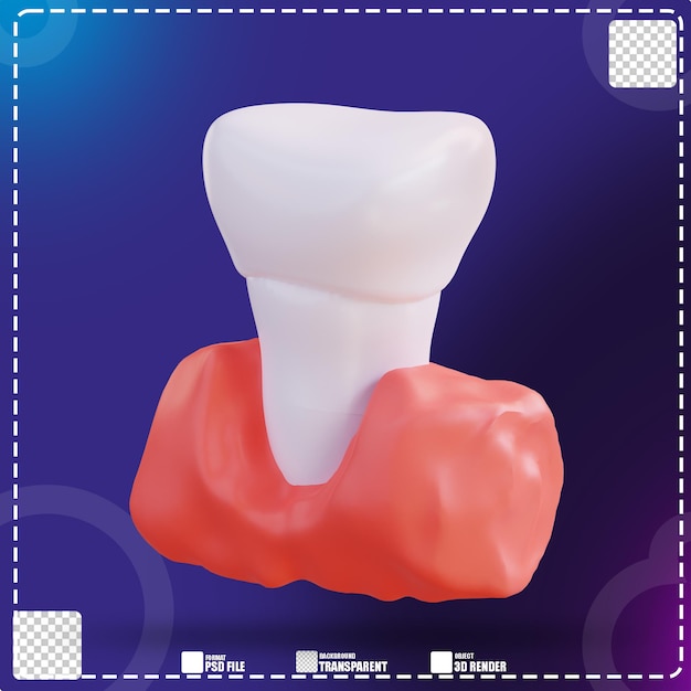 3d Illustration Des Dents Et Des Gencives 2