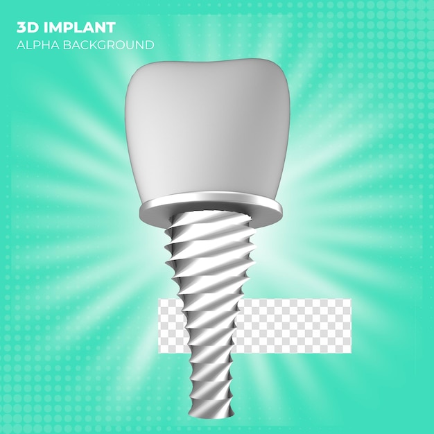 3D-Render-Symbol für weißes Zahnimplantat
