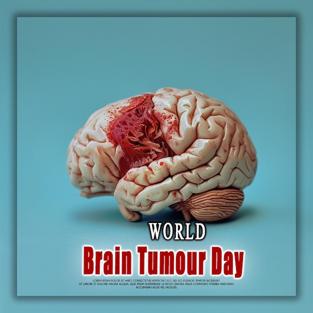 PSD antecedentes do dia mundial do tumor cerebral