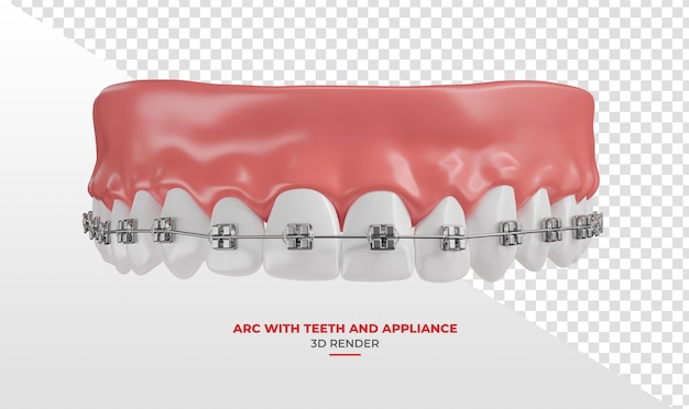 Arche dentaire avec des dents blanches et des appareils orthopédiques en 3D avec un fond transparent