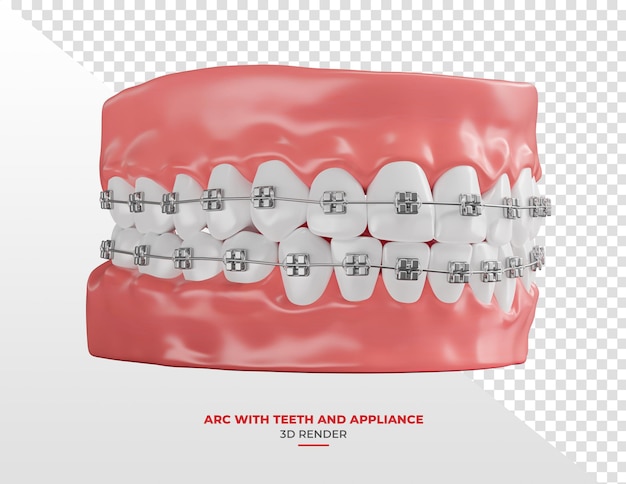 Arche dentaire avec des dents blanches et des appareils orthopédiques en 3D avec un fond transparent