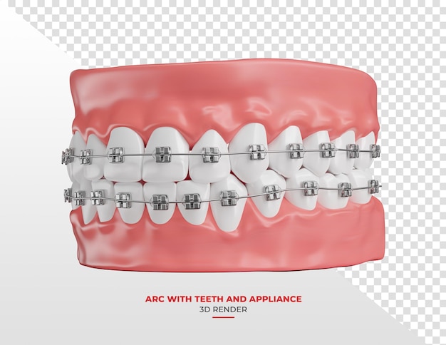 Arche dentaire avec des dents blanches et des appareils orthopédiques en 3D avec un fond transparent