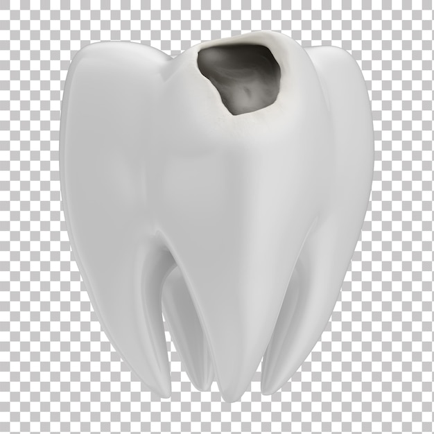 Asset 3D realistic dentist odontologist White tooth with cavity and decay Isolated background