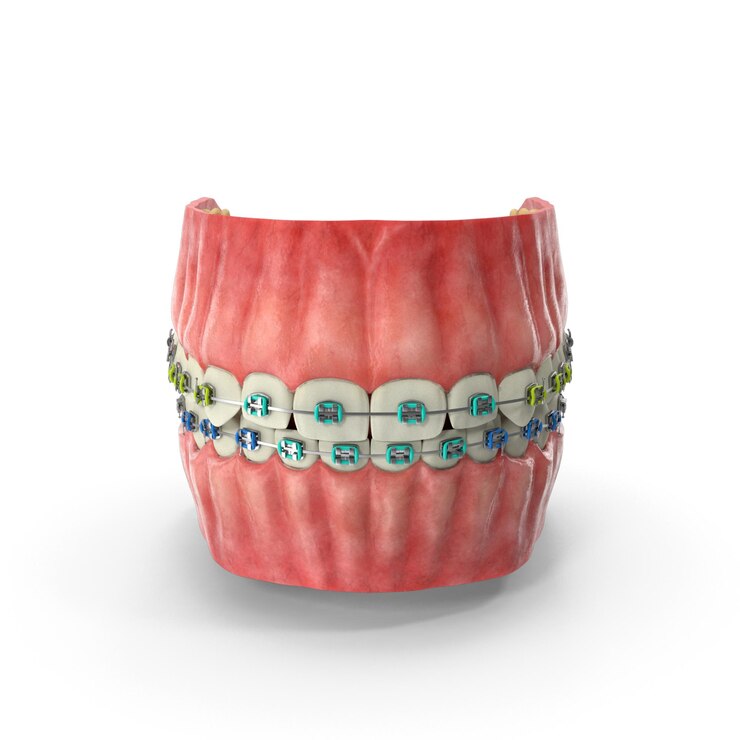 PSD boca humana 3d realista con aparatos dentales de acero archivos psd de diseño ortodóncio de alta calidad