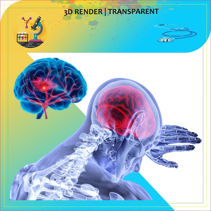 PSD brain anatomy human lungs neurology lungs infection body pain head ache neuro surgery disease
