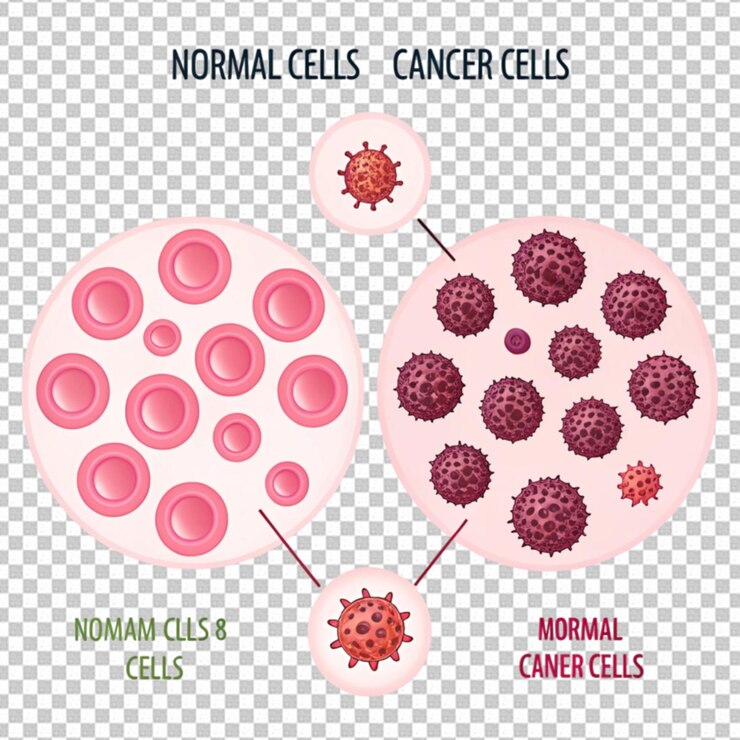 PSD las células normales y defectuosas y la ciencia de las células cancerosas