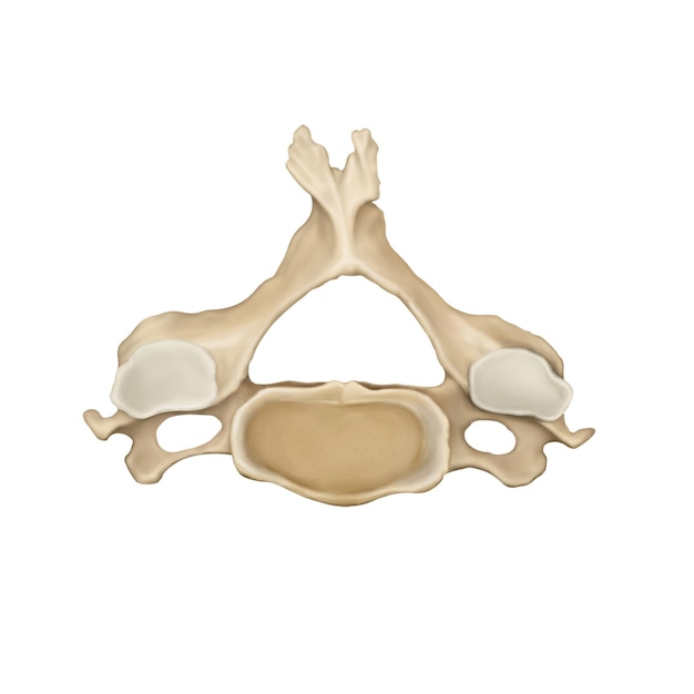 PSD columna cervical