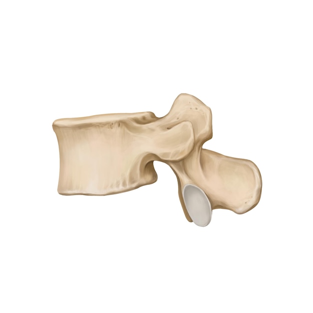 PSD la columna lumbar