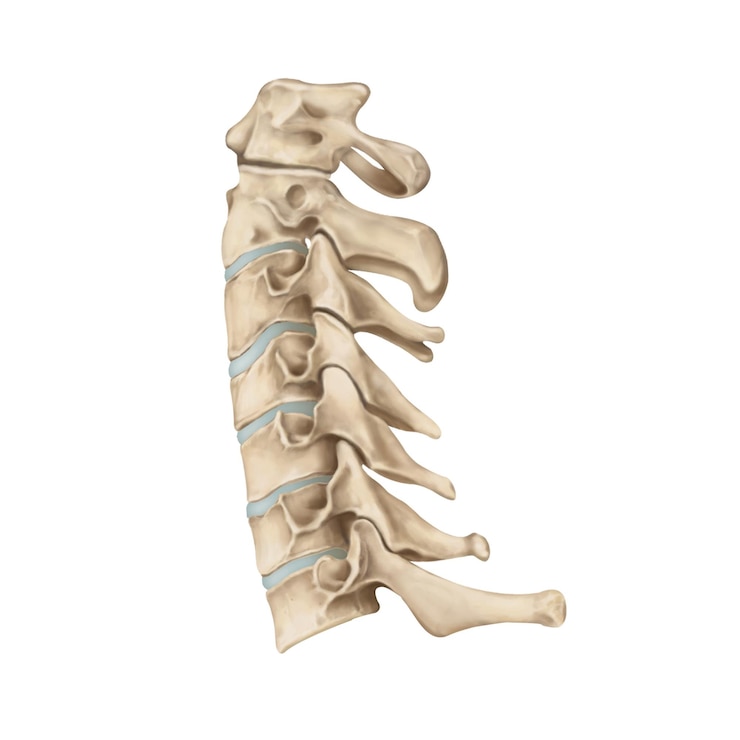 PSD coluna cervical