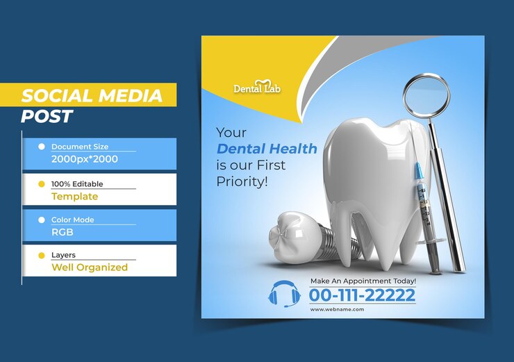 PSD concetto di chirurgia di impianti dentali instagram post banner template.