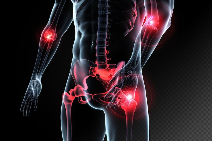 PSD le corps humain points de douleur articulaire diagramme de flux de l'arthrite squelette bleu