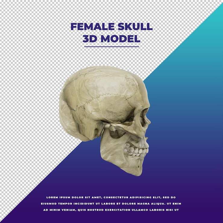 PSD crânio feminino