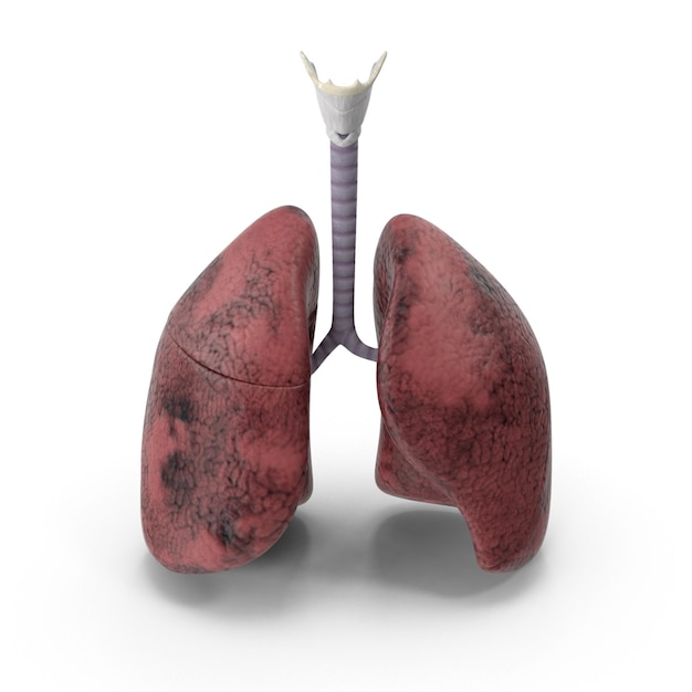 Daños en los pulmones
