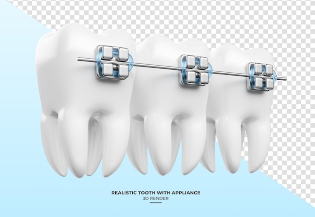 Une dent réaliste avec des appareils dentaires en 3D avec un fond transparent