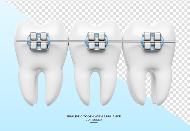 PSD une dent réaliste avec des appareils dentaires en 3d avec un fond transparent