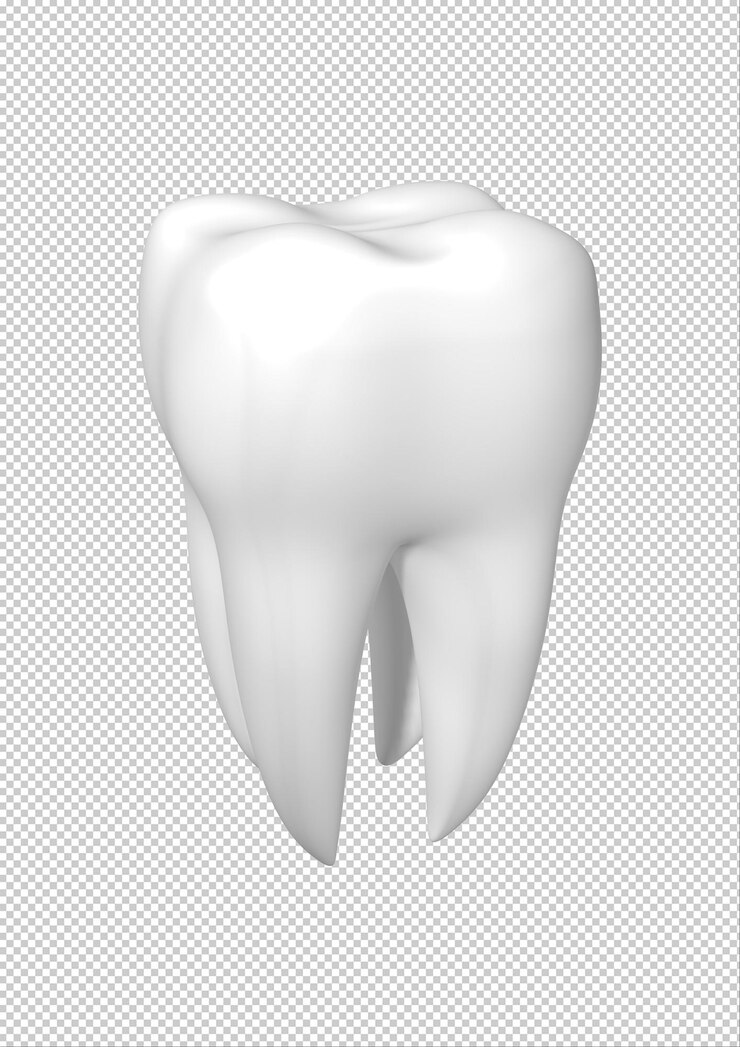 PSD dent