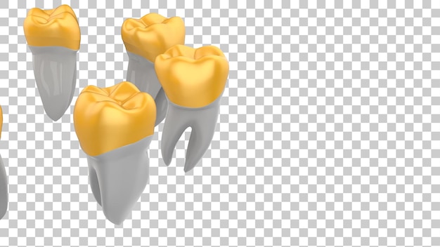 Dente de implante isolado em fundo transparente ilustração de renderização 3d