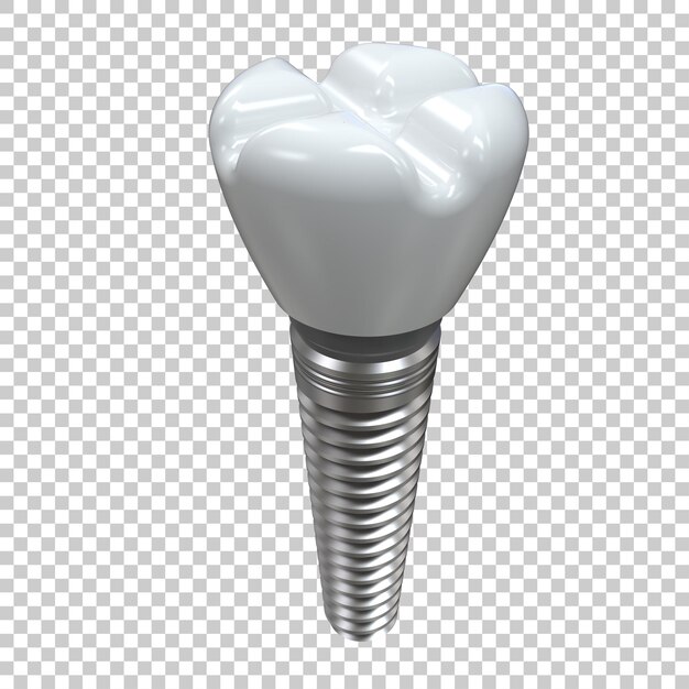 PSD dente de implante isolado em fundo transparente ilustração de renderização 3d